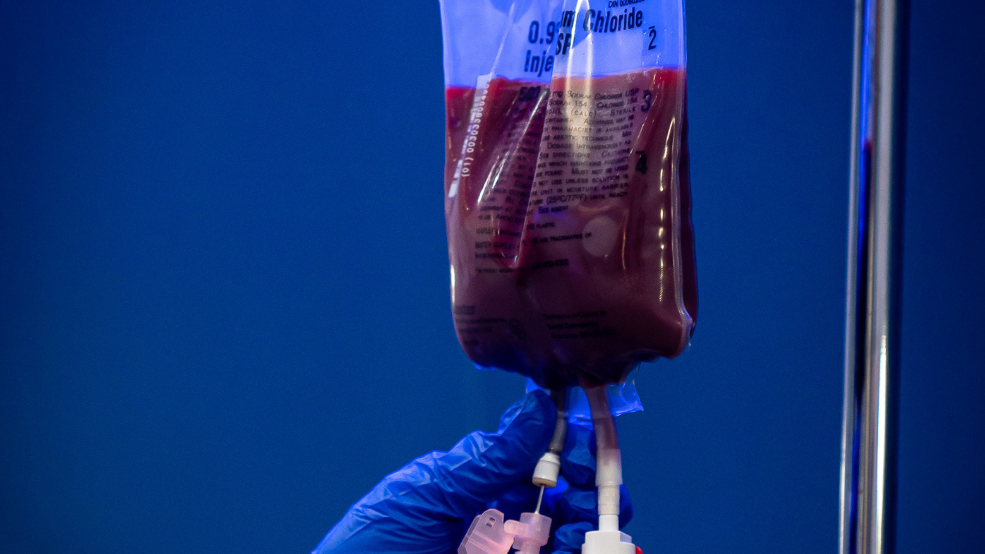 Ozone UV IV therapy session for immune support and cellular detoxification