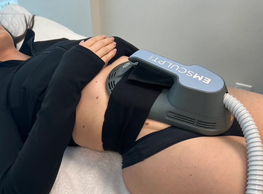 Emsculpt Neo session in progress at iCRYO Charleston Daniel Island